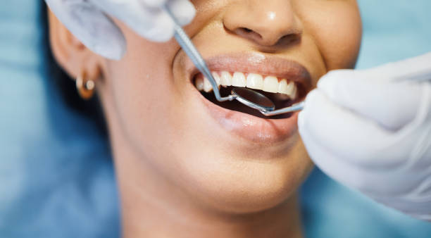 Best Urgent Care for Lost Fillings or Crowns in Gun Barrel City, TX