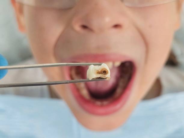 Best Pediatric Emergency Dentist in Gun Barrel City, TX